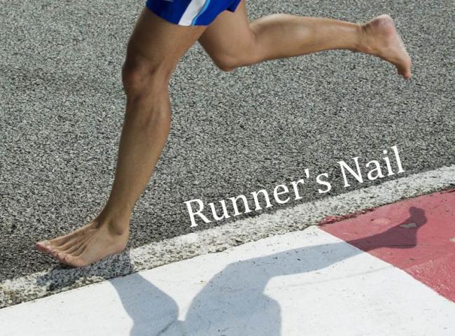 跑者如何保養腳指甲